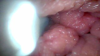 Endoscope Camera Shows the Most Sensitive Parts of the Penis Educational Video
