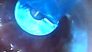 Endoscope POV Test Tube Cock Urethral Insertion