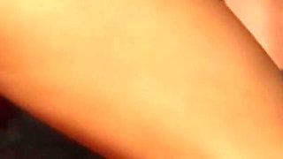 Anal casting