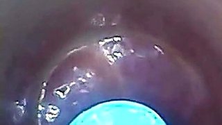 Endoscope POV: Test Tube Cock Urethral Insertion