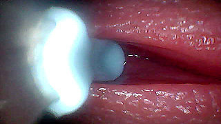 I couldn't believe what happens INSIDE the penis as sperm passes through (endoscopic footage)