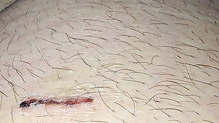 Step mom help injured step son with low erection with a handjob