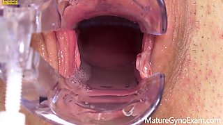 Cervix Of Shy Milf Revealed!