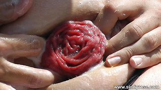Sindy Rose Self Fisting Her Ass Hole Near Cactus & Anal Prolapse