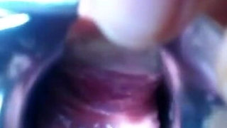 Speculum Cervix & Anal Exam Great View Inside