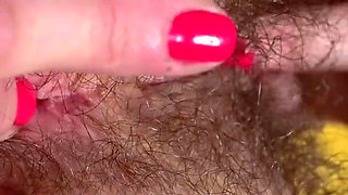 The wax from the candle got on my hairy pubis and it got hot