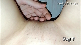 Pussy Hair Growth after deep bikini sugar wax