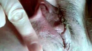 French Aunty's Private Gyno Cam Exam