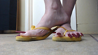 Toenails hanging off yellow flip flops