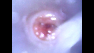 View Inside Cock While Jerking and Cumshot ( Camera Inside Dick )