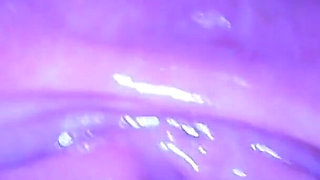Speculum & Microcamera for Lady Soniac