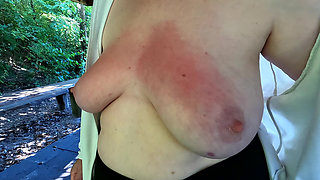 Red and Swollen Tits at Public Bbq Place